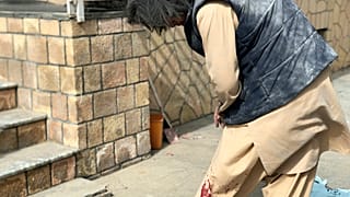 Sebesült férfi a Mazar-i Sharif-i robbantás után 2023. március 11-én