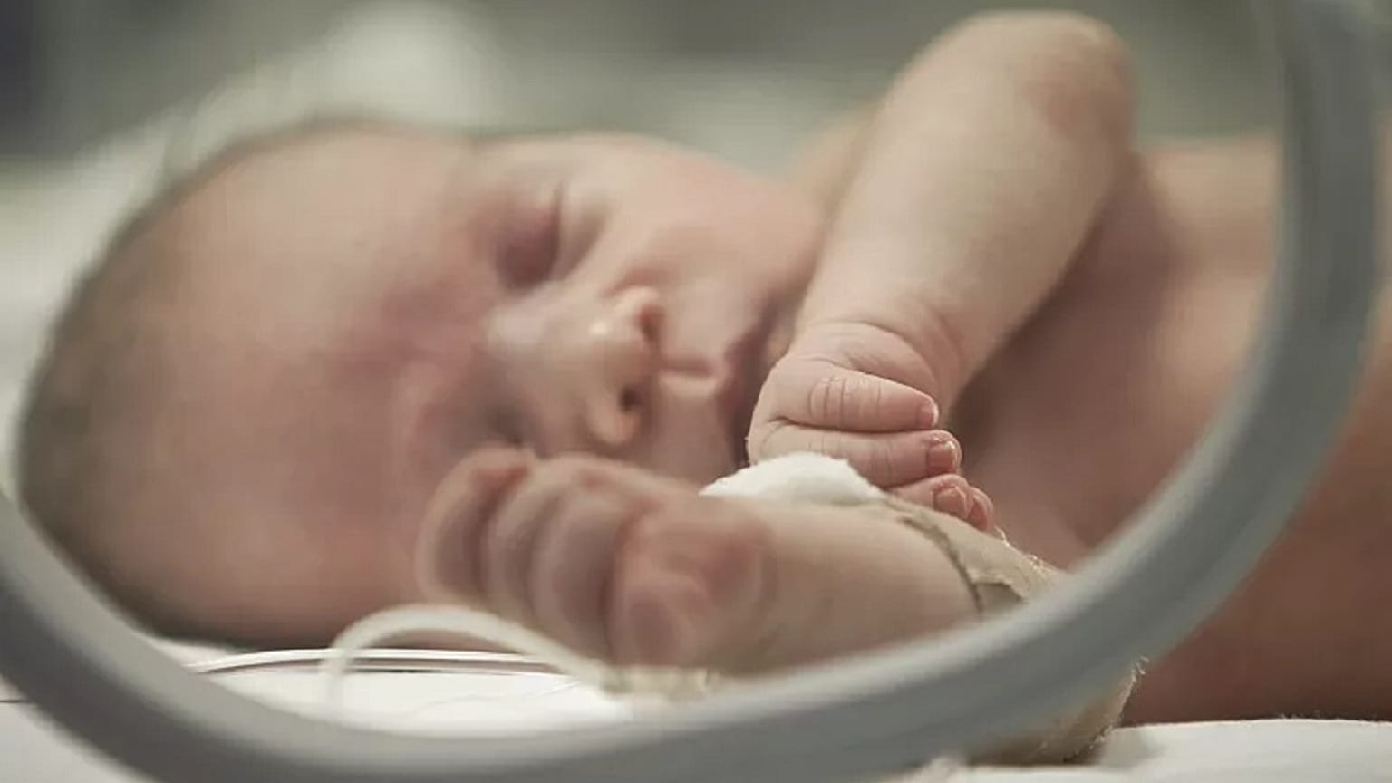 Ein Neugeborenes auf der neonatologischen Intensivstation in Bukarest, Rumänien - Archiv 2012