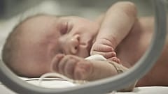 Ein Neugeborenes auf der neonatologischen Intensivstation in Bukarest, Rumänien - Archiv 2012