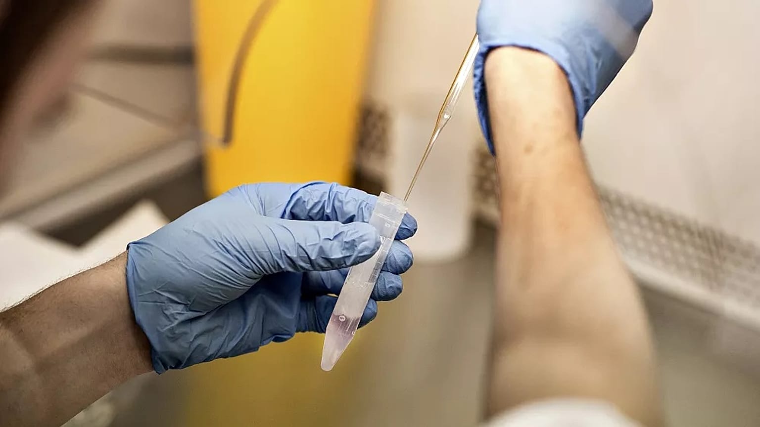 Sperm bağışı
