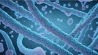 Marburg virus is a highly infectious 'cousin' of ebola.
