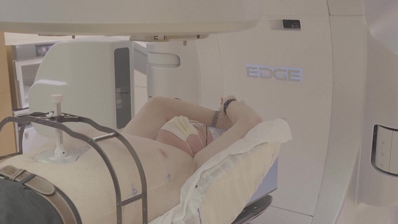 Doctors are testing whether radiation can heal an irregular heartbeat