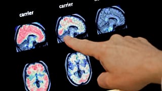 Médico analisa um exame ao cérebro