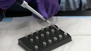 La donazione mitocondriale rappresenta una soluzione per scongiurare malattie genetiche
