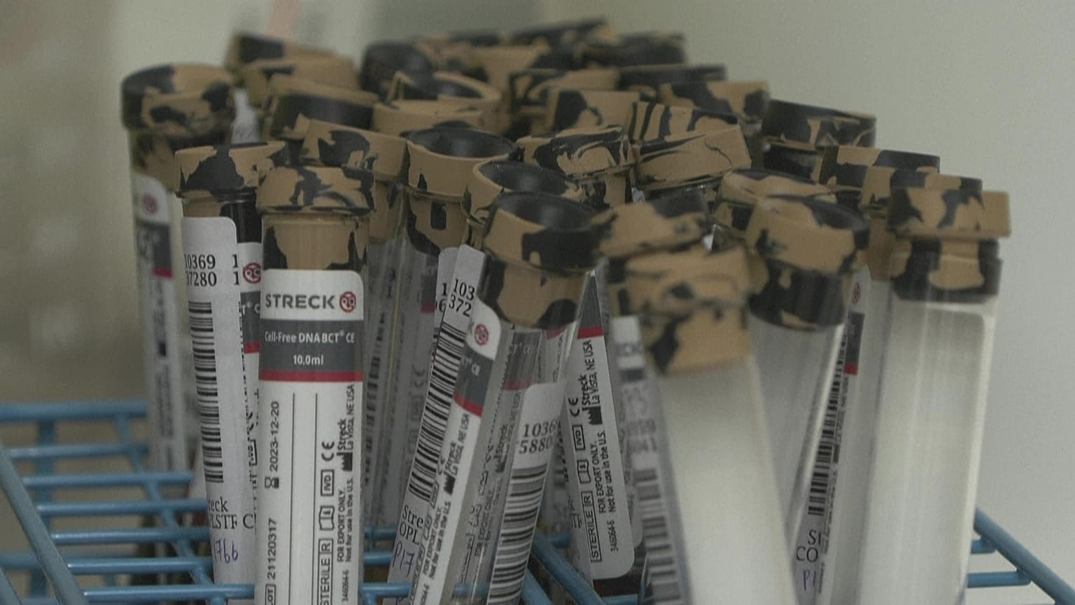 Early blood test may unravel secrets of pregnancy loss