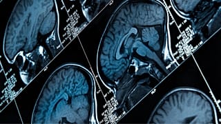 Researchers have decoded brain signals for pain for the first time