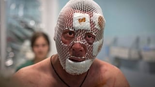 Sérült ukrán katona