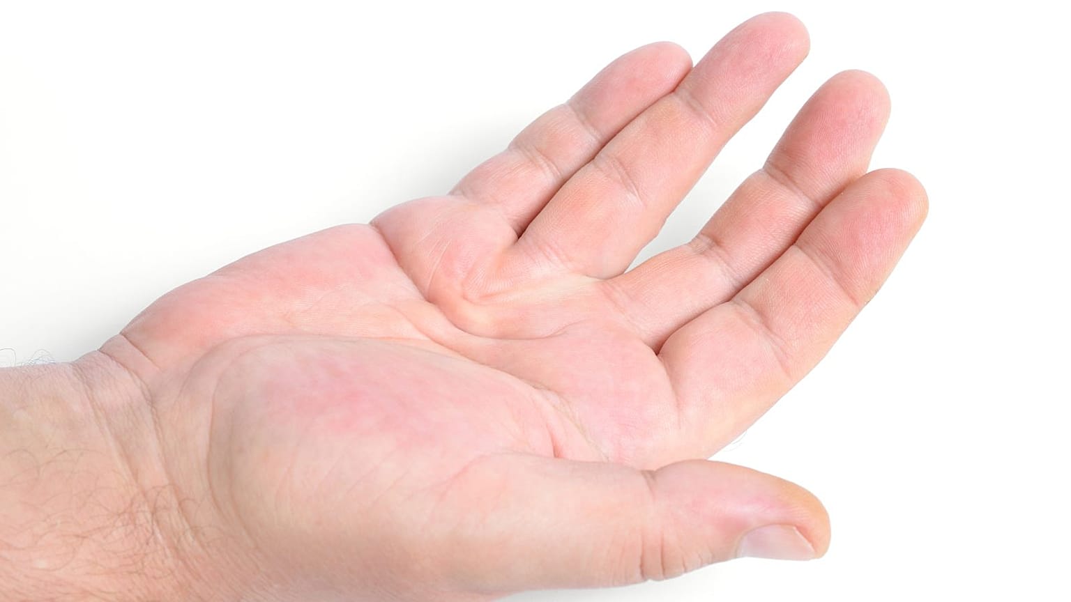 بیماری وایکینگ