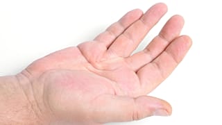 بیماری وایکینگ