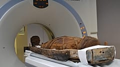 Απεικονιστική εξέταση μούμιας στον αξονικό τομογράφο του Ιατρικού Κέντρου Αθηνών