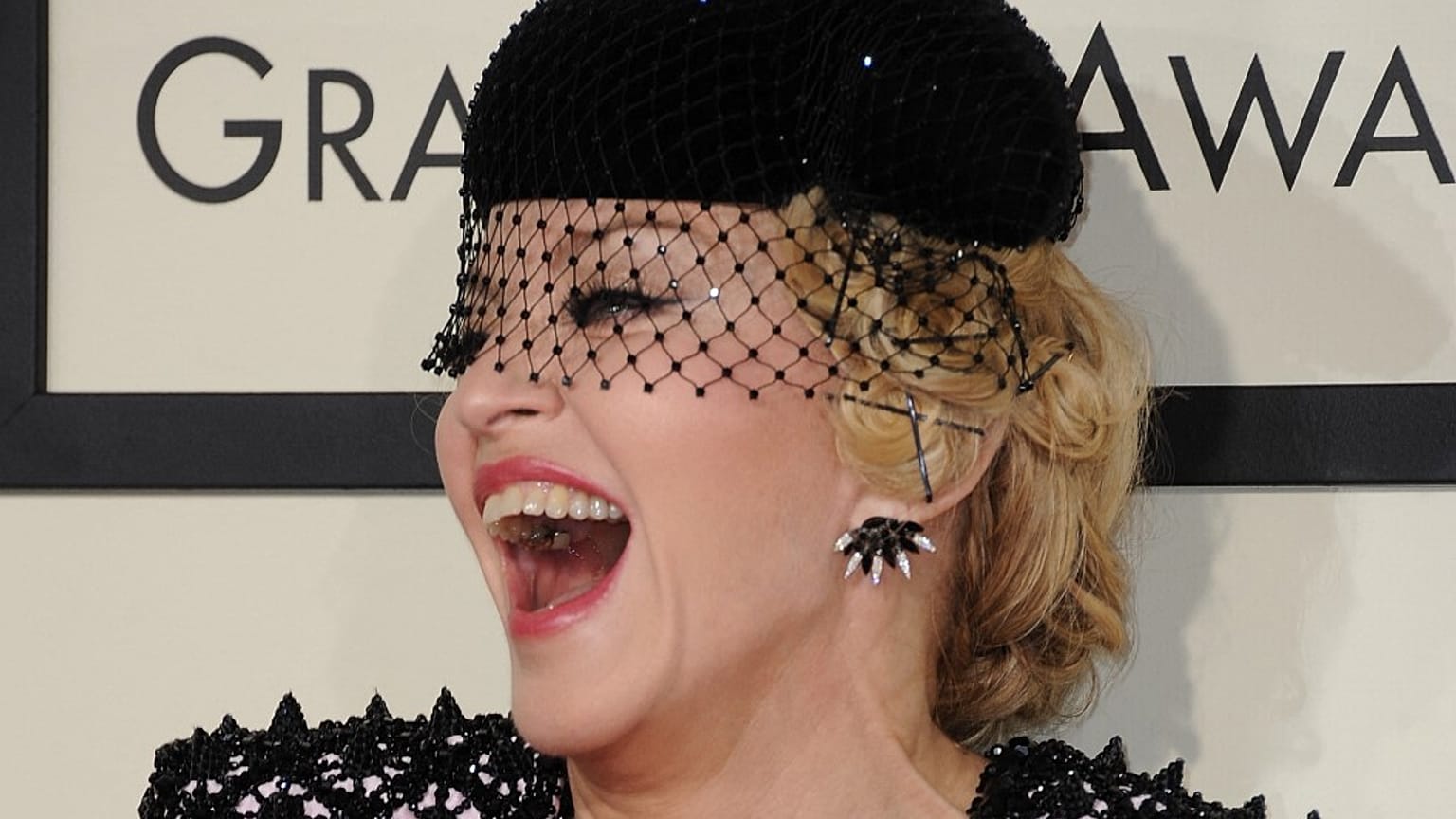 Madonna viene dimessa dall'ospedale