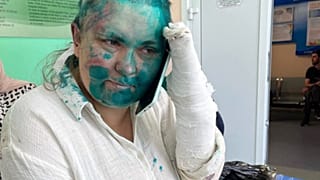  Elena Milashina quelques heures après son agression dans un hôpital de Grozny (Tchétchénie), le 4 juillet 2023.