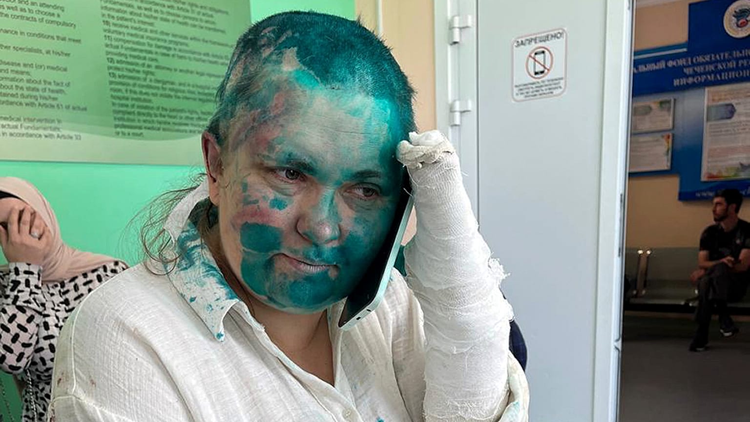 Jornalista Elena Milashina no hospital após ser atacada