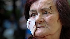 Hanna Fedorenko ficou ferida por um dos mísseis russos que atingiram Lviv