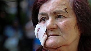 Hanna Fedorenko ficou ferida por um dos mísseis russos que atingiram Lviv