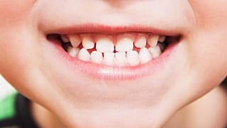 Scientists are getting close to a drug that makes teeth regrow