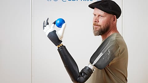 Patient wearing a prosthetic limb in the lab at the Center of Bionics and Pain research.
