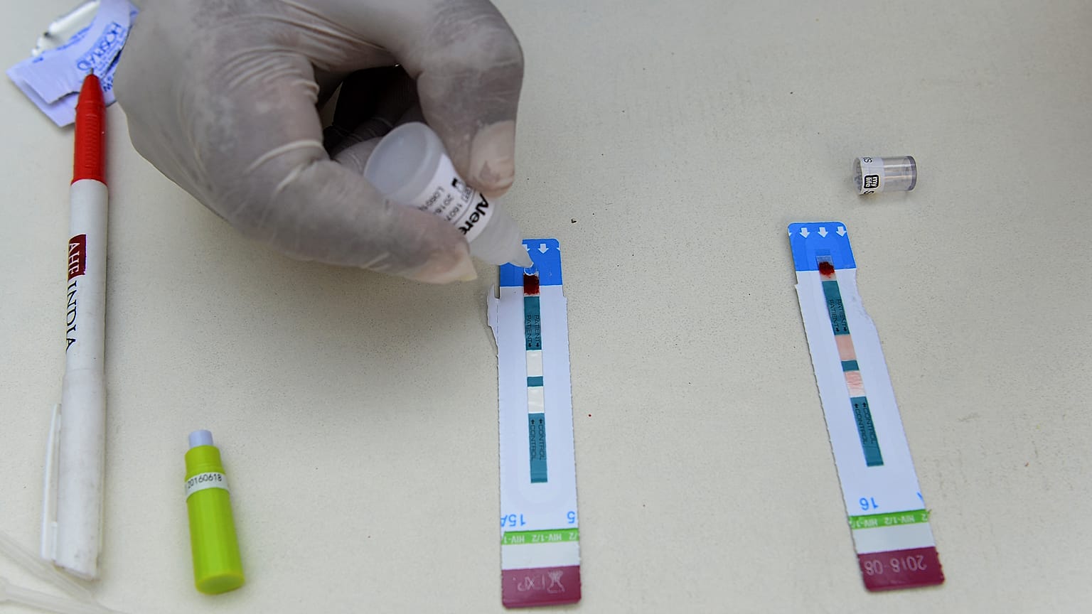HIV testi