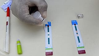 HIV testi