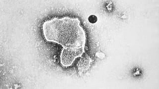 This 1981 electron microscope image provided by the Centers for Disease Control and Prevention shows a human respiratory syncytial virus, also known as RSV.