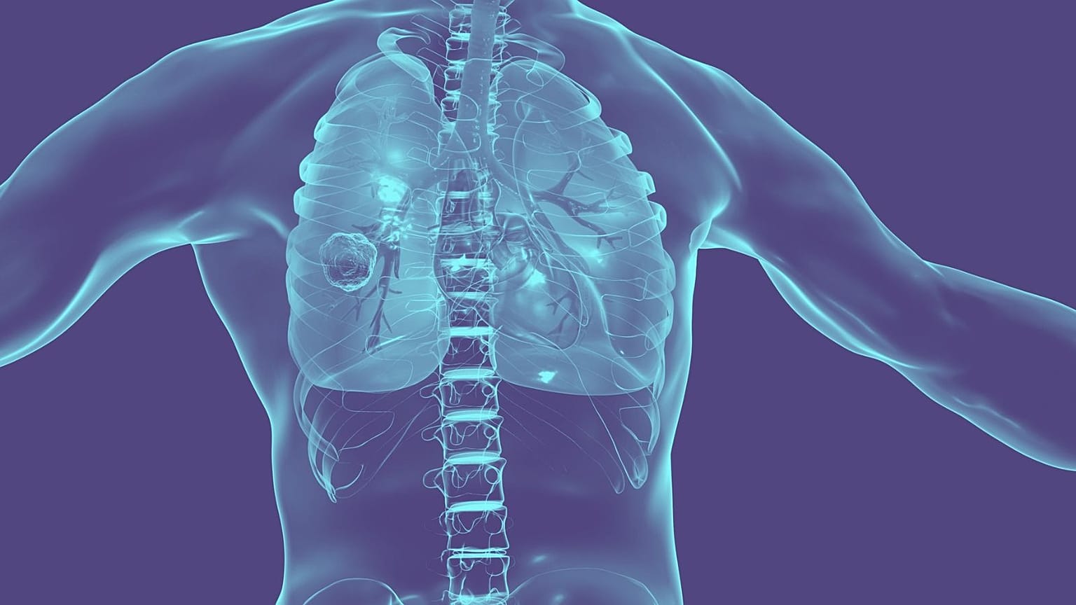 Researchers in the UK have tested a robot tentacle which can reach deep in the lungs to treat cancer.