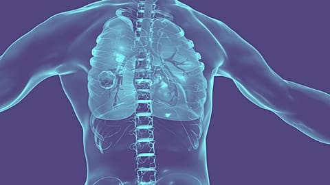 Researchers in the UK have tested a robot tentacle which can reach deep in the lungs to treat cancer.