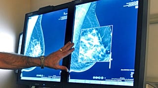 Foto de archivo una radiología, el 31 de julio de 2012