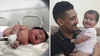 على اليمن الطفلة عفراء ووالدها بالتبين خليل السوادي، (اليسار) الطفلة عفراء بعد وصولها إلى المستشفى بعد وقوع الزلزال