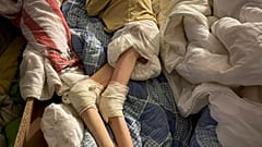 A malnourished child lies on an improvised bed in the basement of a care home in in the village of Bardesti.