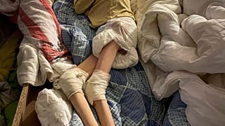 A malnourished child lies on an improvised bed in the basement of a care home in in the village of Bardesti.