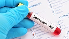آزمایش تستوسترون 