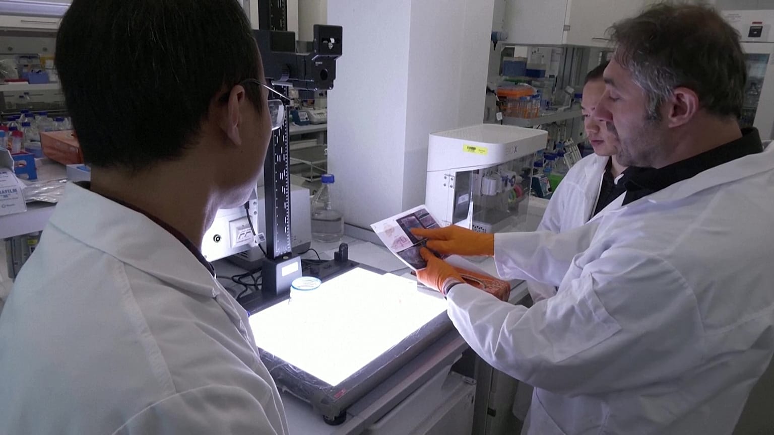 Scientists have found a new approach to diagnose brain diseases.