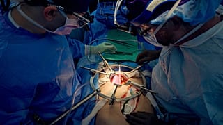 كلية خنزير تواصل العمل في جسد رجل متوفى دماغيا، في جامعة نيويورك لانجون هيلث، في 14 يوليو 2023
