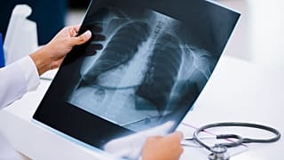Um médico examina uma radiografia do tórax.