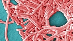 A Centers for Disease Control and Prevention által közzétett képen a Legionella pneumophila baktériumok nagy csoportja
