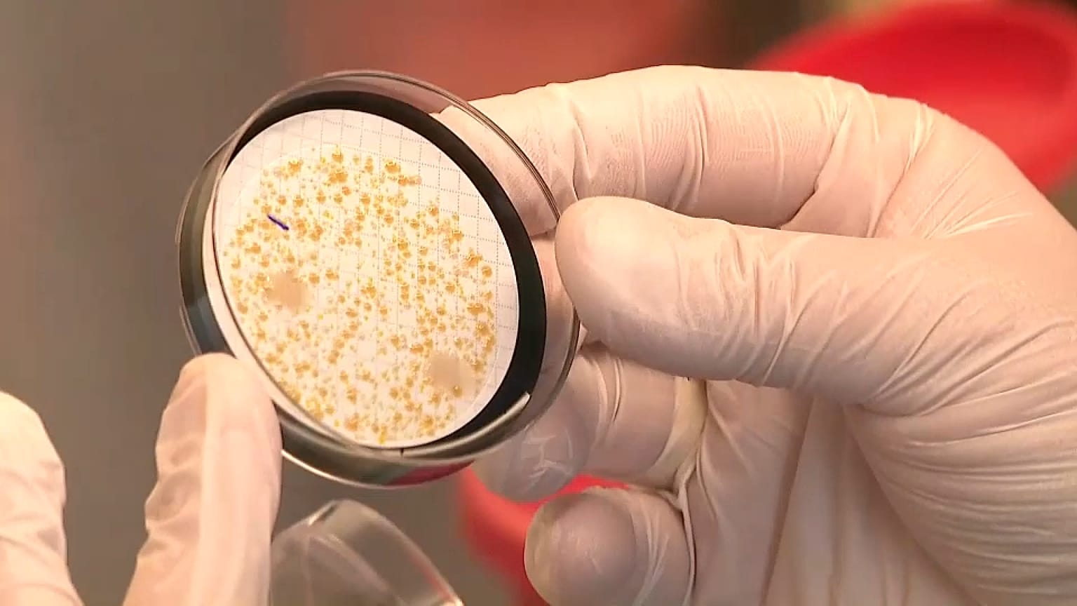 Legionella bacteria 