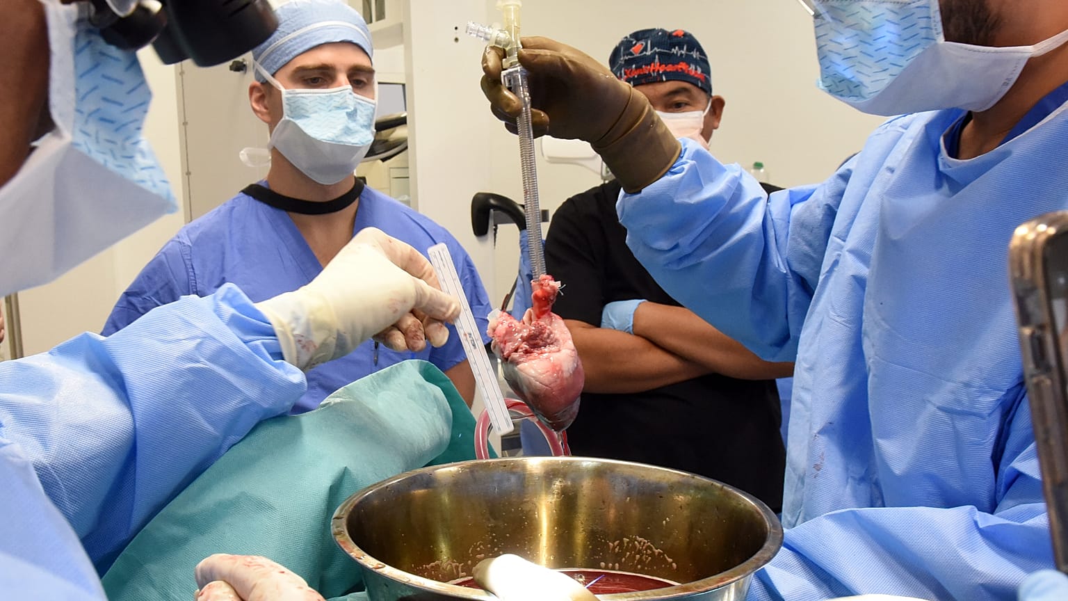  عملية جراحية لزرع قلب خنزير معدل جينيا لإنسان في مستشفى كليّة الطب بجامعة ميريلاند في الولايات المتحدة