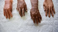 Hyperrealistic prosthetic hands for the disabled, in La Paz, Bolivia September 19, 2023.