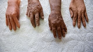 Hyperrealistic prosthetic hands for the disabled, in La Paz, Bolivia September 19, 2023.