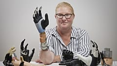 Die hochintegrierte bionische Hand hat bemerkenswerte Verbesserungen gezeigt