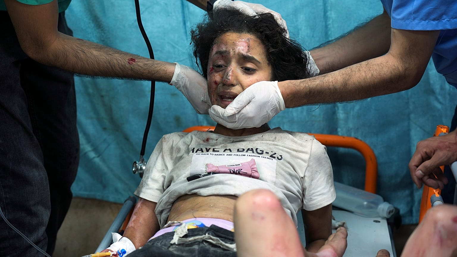 طفل فلسطيني أصيب بقصف إسرائيلي في مستشفى بدير البلح جنوب قطاع غزة