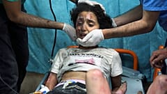 طفل فلسطيني أصيب بقصف إسرائيلي في مستشفى بدير البلح جنوب قطاع غزة
