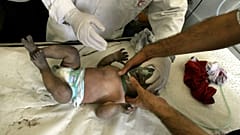 مسعفون فلسطينيون يعالجون طفلا بعد قصف  إسرائيلي لمنزل عائلة فلسطينية  في مدينة غزة