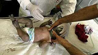 مسعفون فلسطينيون يعالجون طفلا بعد قصف إسرائيلي لمنزل عائلة فلسطينية في مدينة غزة