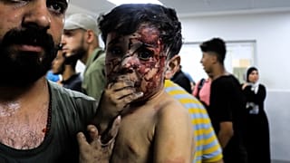 Ein verletzter Junge in Gaza