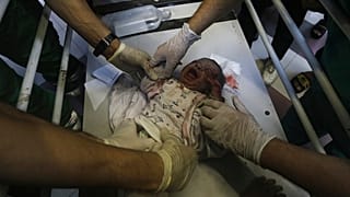 Légicsapásban mgsebesült palesztin csecsemő a gázai Al-Shifa kórházban 2023. október 23-án