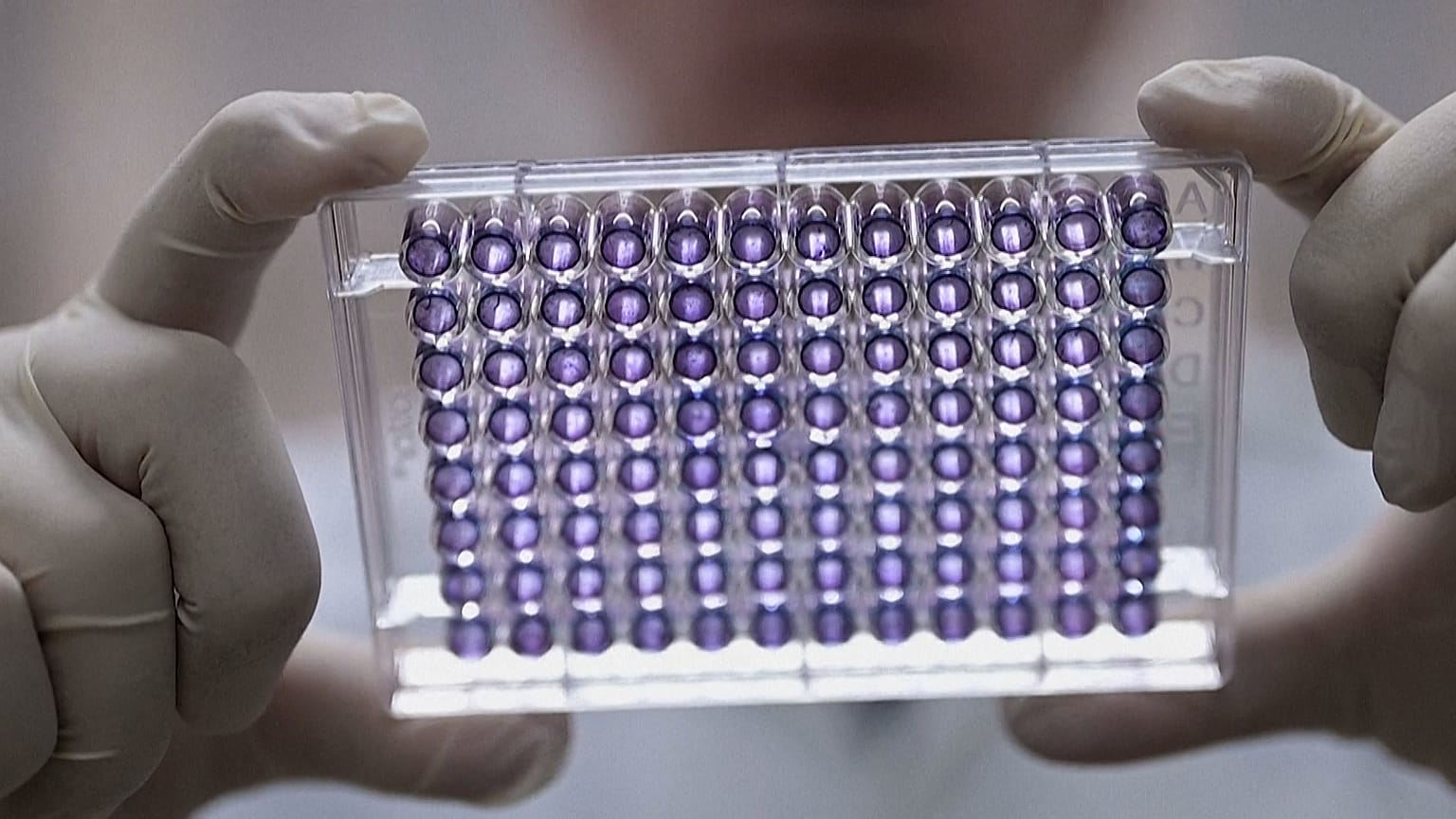 Des chercheurs brésiliens mettent au point un vaccin pour traiter la dépendance à la cocaïne et à son puissant dérivé, le crack.