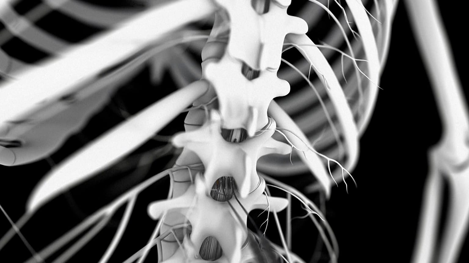 Image shows a concept rendering of the spinal electrode system that could help ease symptoms for Parkinson's disease patients.