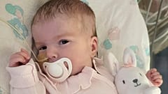 Ölümcül mitokondriyal hastalığı bulunan 8 aylık Indi bebek hayata gözlerini yumdu