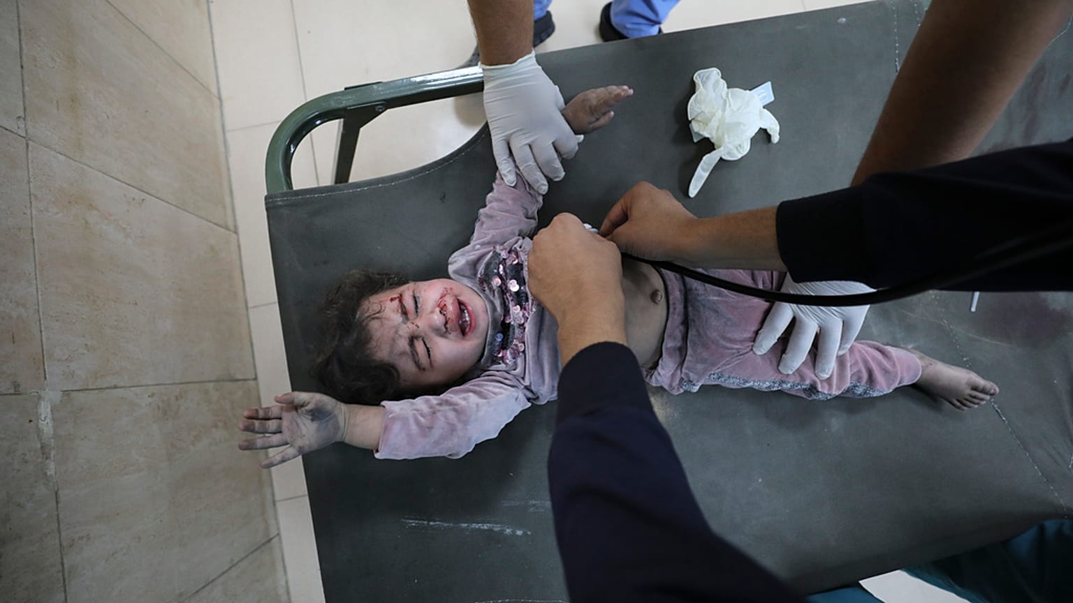 Palestinian child wounded in the Israeli bombardment of the Gaza Strip is treated at al Aqsa Hospital on Deir al Balah, Gaza Strip, Tuesday, Nov. 21, 2023.